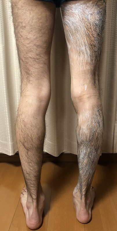 除毛クリーム（メンズ）HMENZ、除毛クリームを塗った後ろ足